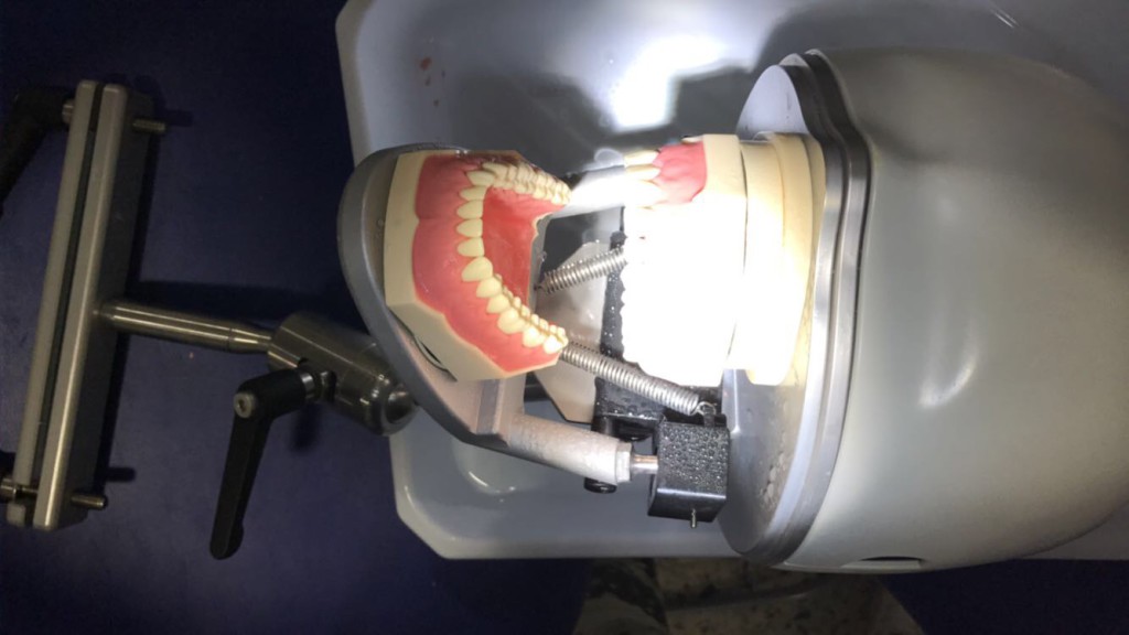 impresión dental con alginato