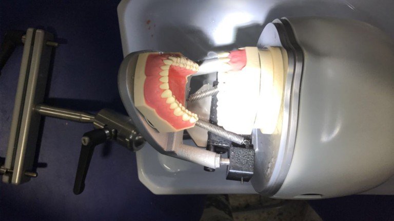 impresión dental con alginato